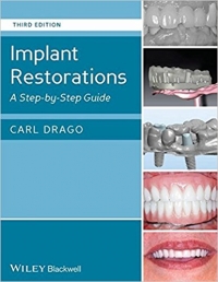 دانلود کتاب ترمیم ایمپلنت Implant Restorations: A Step-by-Step Guide 3ED