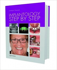 دانلود کتاب ایمپلنتولوژی قدم به قدم Implantology Step by Step