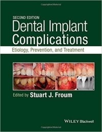 دانلود کتاب عوارض ایمپلنت :علل:پیشگیری و درمان Dental Implant Complications 2ED