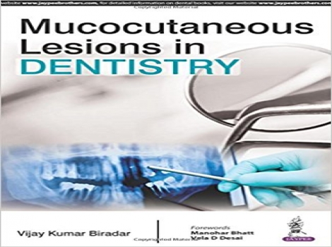 دانلود کتاب ضایعات مخاطی در دندانپزشکی Mucocutaneous Lesions in Dentistry 1ED