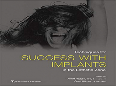 Techniques for Success With Implants in the Esthetic Zone 1st Edition