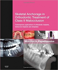 دانلود کتاب درمان کلوژن کلاس2 اسکلتی انکوریج Skeletal Anchorage in Orthodontic Treatment