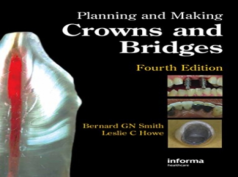 دانلود کتاب Planning and Making Crowns and Bridges 4 ED