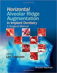 دانلود کتاب تقویت ریج آلوئولار افقی در ایمپلنت Horizontal Alveolar Ridge Augmentation in Implant Dentistry