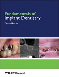 دانلود کتاب اصول ایمپلنت بایرن  Fundamentals of Implant Dentistry 1ED