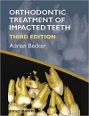 دانلود کتاب ارتودنسی دندان نهفته بکرOrthodontic Treatment of Impacted Teeth 3 ED
