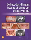 دانلود کتاب برنامه ریزی ایمپلنت مبتنی بر شواهد Evidence-based Implant Treatment Planning and Clinical Protocols