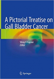 دانلود کتاب سرطان کیسه صفرا A Pictorial Treatise on Gall Bladder Cancer 1st ed. 2021 Edition