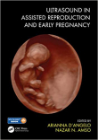 دانلود کتاب Ultrasound in Assisted Reproduction and Early Pregnancy