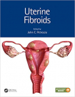 دانلود کتاب فیبروئید رحم Uterine Fibroids