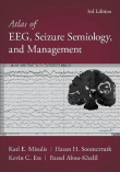دانلود کتاب اطلس EEG Atlas of EEG, Seizure Semiology, and Management 3rd Edition