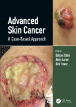 دانلود کتاب سرطان پوست پیشرفته Advanced Skin Cancer: A Case-Based Approach