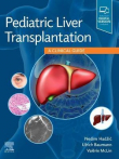 دانلود کتاب راهنمای بالینی پیوند کبد کودکان Pediatric Liver Transplantation A Clinical Guide