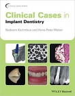 دانلود کتاب کیس‌های بالینی در دندانپزشکی ایمپلنت 2017 Clinical Cases in Implant Dentistry 1 ED