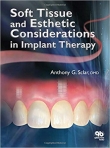 دانلود کتاب Soft Tissue and Esthetic Considerations in Implant Therapy